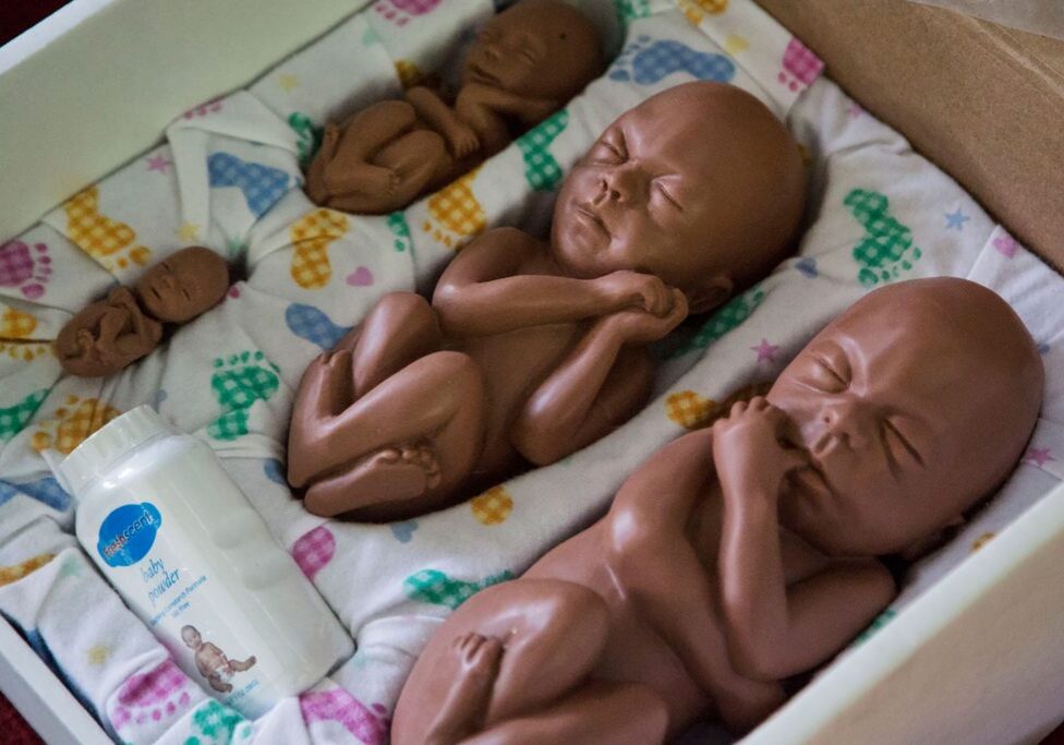 Models of fetuses that are supposed to show different stages of pregnancy are seen during a lecture of Soman Rai, a pastor who founded the non-profit Voice of Fetus Nepal at a small church in the village of Shilaprabat, Sindhupalcholk district, Nepal, July 14, 2017. 